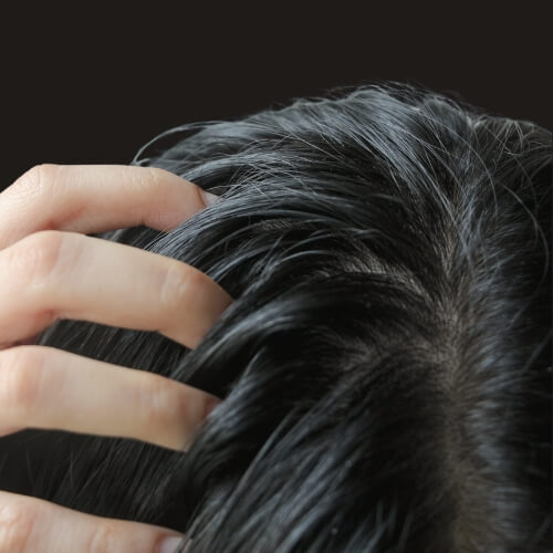 Oily scalp / greasy roots